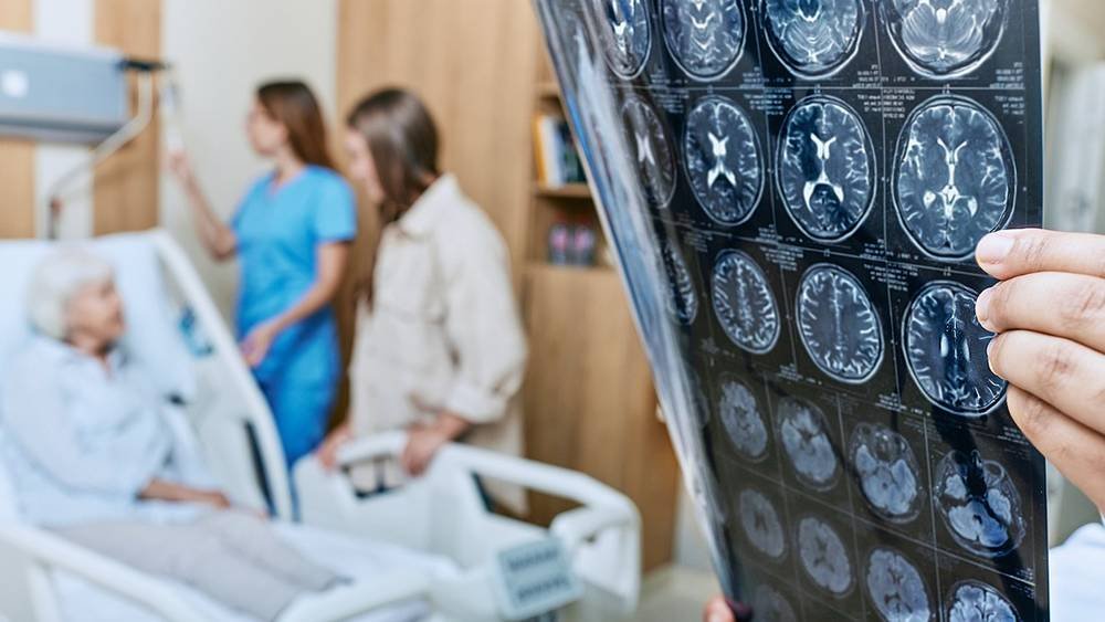 Descubren casos extraños de posible transmisión del alzhéimer en personas que recibieron tratamientos médicos descontinuados