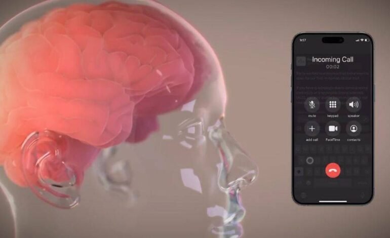 Neuralink: Elon Musk anuncia éxito en su primera prueba de implante cerebral en humanos