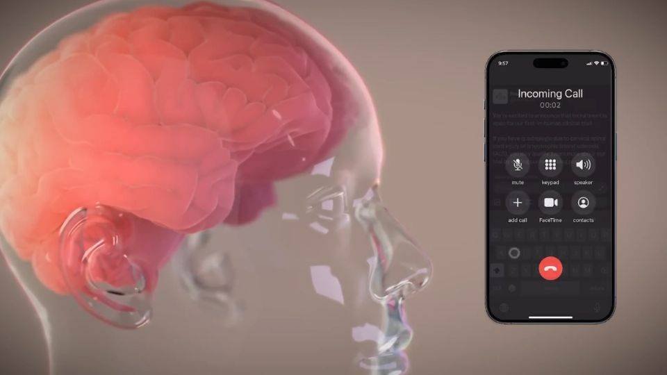 Neuralink: Elon Musk anuncia éxito en su primera prueba de implante cerebral en humanos